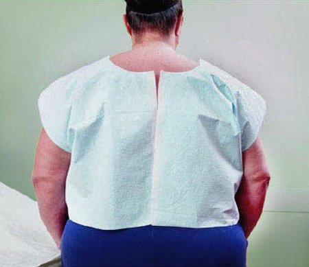 Picture of Exam Cape Tidi® Blue X-Large Front / Back Opening Without Closure Unisex910517