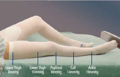 Picture of Anti-embolism Stocking T.E.D.™ Knee High 2X-Large / Regular White Inspection Toe7470LF