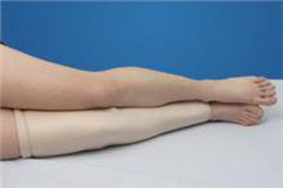 Picture of Protective Leg Tube DermaSaver™ X-Large66417/NA/NA/XL