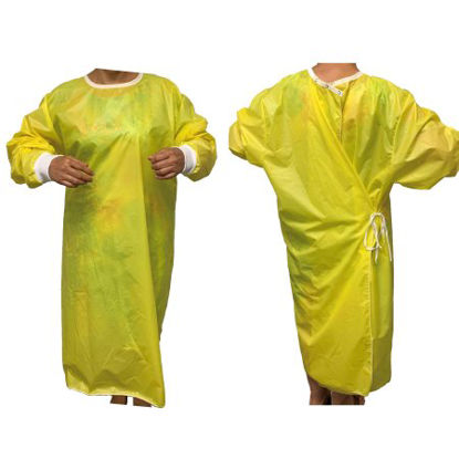 Picture of Protective Procedure Gown One Size Fits Most Yellow NonSterile AAMI Level 3 ReusableM90-ISOGW-AS