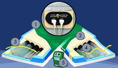 Picture of Alternating Pressure Mattress PressureGuard® APM2 Alternating Pressure System 42 X 80 Inch3715629