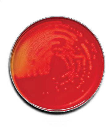Picture of Prepared Media BD BBL™ Trypticase™ Soy Agar with 5% Sheep Blood (TSA II™) Dark Red Mono-Plate Format221261