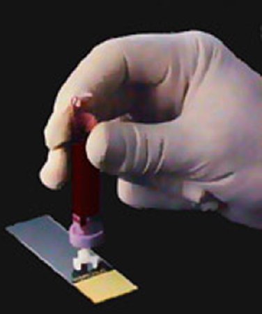 Picture of Blood Dispenser DIFF-SAFE® 21 Gauge X 1/2 Inch Needle For Blood Smears101