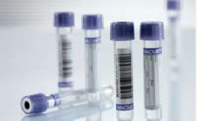 Picture of VACUETTE® Venous Blood Collection Tube Whole Blood Tube K3 EDTA Additive 13 X 75 mm 4 mL Lavender / Black Ring Pull Cap Polyethylene Terephthalate (PET) Tube454021