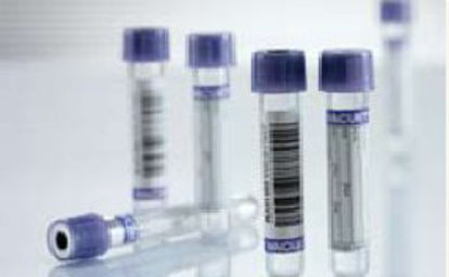 Picture of VACUETTE® Venous Blood Collection Tube Whole Blood Tube K3 EDTA Additive 13 X 75 mm 4 mL Lavender / Black Ring Pull Cap Polyethylene Terephthalate (PET) Tube454021