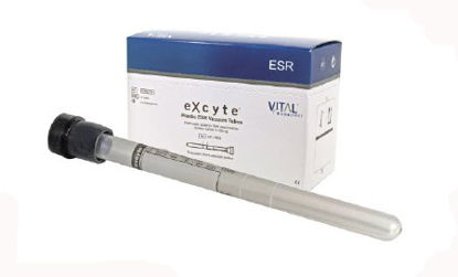 Picture of Excyte® Vacuum Tube Venous Blood Collection Tube Erythrocyte Sedimentation Rate (ESR) Sodium Citrate Additive 120 mm Length 1.36 mL Black Conventional Closure Plastic TubeEP-10605