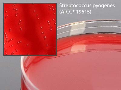 Picture of Prepared Media Selective Beta Strep Agar (Group A Strep only) Mono-Plate FormatA72
