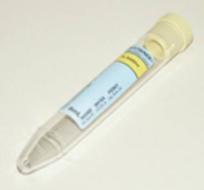 Picture of BD Vacutainer® Urinalysis Tube Conical Bottom Plain 16 X 100 mm 8 mL Yellow Conventional Closure Plastic Tube364980