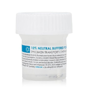 Picture of Prefilled Formalin Container StatClick™ Polypropylene 20 mL Fill in 40 mL (1.35 oz.) Screw Cap Warning Label NonSterileNB0115