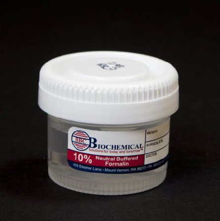 Picture of Prefilled Formalin Container BBC Biochemical Trans-Pak™ Polypropylene 20 mL Fill in 40 mL (1.35 oz.) Screw Cap Patient Information NonSterileMA0102011