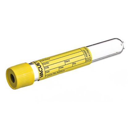 Picture of VACUETTE® Z Urine No Additive Urinalysis Tube Round Bottom Plain 16 X 100 mm 10.5 mL Yellow Pull Cap Polyethylene Terephthalate (PET) Tube455007
