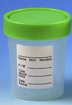 Picture of Specimen Container 53 mm Opening Polypropylene 90 mL (3 oz.) Screw Cap Patient Information Sterile22150106