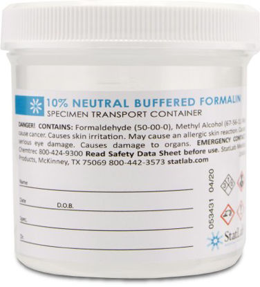 Picture of Prefilled Formalin Container Polypropylene 90 mL Fill in 180 mL (6 oz.) Screw Cap Warning Label / Patient Information NonSterileNB0690