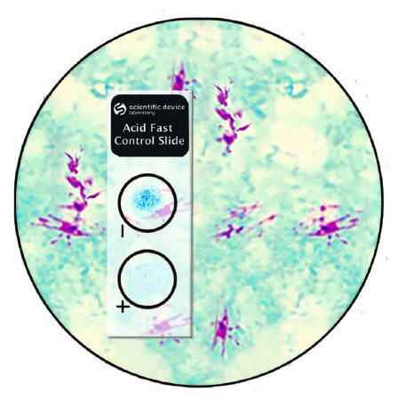 Picture of Microbial Identification Control Slide Acid Fast Stain Positive Level / Negative Level 10 Slides351