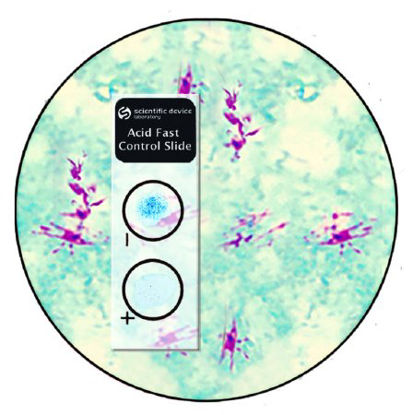 Picture of Microbial Identification Control Slide Acid Fast Stain Positive Level / Negative Level 10 Slides351