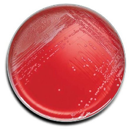 Picture of Prepared Media BD BBL™ Phenylethyl Alcohol Agar with 5% Sheep Blood Red Mono-Plate Format221179