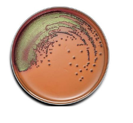 Picture of Prepared Media BD BBL™ Levine Eosin Methylene Blue (EMB) Agar Plate Format221170