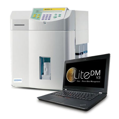 Picture of Hematology Analyzer ABX Micros 60® CLIA Moderate Complexity5300001371