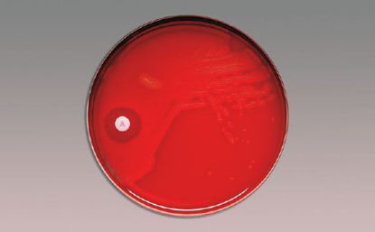 Picture of Differentiation Disc BBL™ Taxo™ A Bacitracin 0.04 U231041