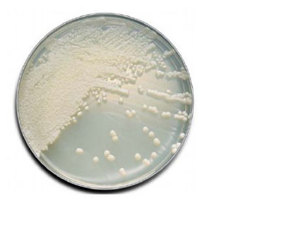 Picture of Prepared Media BD BBL™ Sabouraud Dextrose Agar Light Beige Mono-Plate Format221180