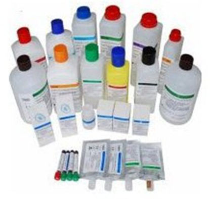 Picture of Reagent Abx Pentra™ Immunochemistry / Immunodiagnostic Assay Lactic Acid For ABX Pentra™ 400 260 Tests1220001721