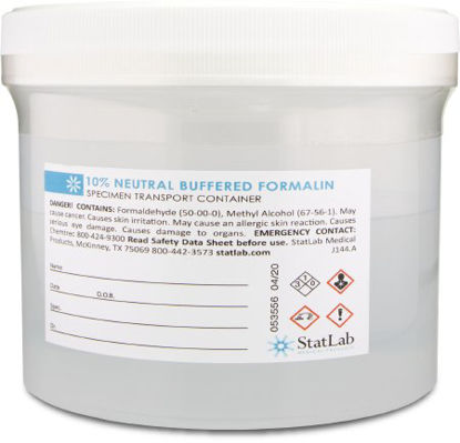 Picture of Prefilled Formalin Container Polypropylene 500 mL Fill in 1,000 mL (32 oz.) Screw Cap Warning Label / Patient Information NonSterileNB32480