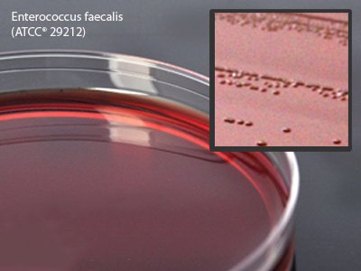 Picture of Prepared Media Levine Eosin Methylene Blue (EMB) Agar Plate FormatG25