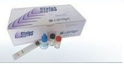 Picture of Reagent Kit Status Mono™ Infectious Disease Immunoassay Infectious Mononucleosis 30 Tests84W30