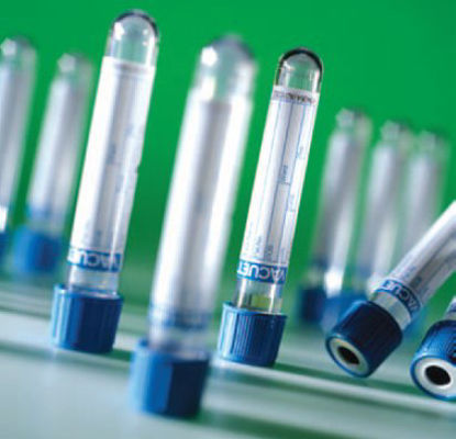 Picture of VACUETTE® Venous Blood Collection Tube Coagulation Tube Sodium Citrate Additive 13 X 75 mm 1.8 mL Light Blue / White Ring Pull Cap Polyethylene Terephthalate (PET) Tube22040045