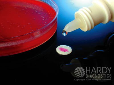 Picture of Rapid Test Kit Microbial Identification Group A Streptococci and Enterococci Culture Sample 100 TestsZ175