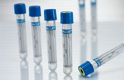 Picture of VACUETTE® Venous Blood Collection Tube Coagulation Tube Sodium Citrate Additive 13 X 75 mm 3.15 mL Light Blue / Black Ring Pull Cap Polyethylene Terephthalate (PET) Tube454331