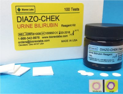 Picture of Test Kit DIAZO-CHEK Hepatic / General Chemistry Bilirubin Urine Sample 100 TestsB1009