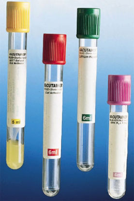 Picture of BD Vacutainer® Plus Venous Blood Collection Tube Glucose Determination Sodium Fluoride / Potassium Oxalate Additive 13 X 75 mm 2 mL Gray BD Hemogard™ Closure Plastic Tube0268846