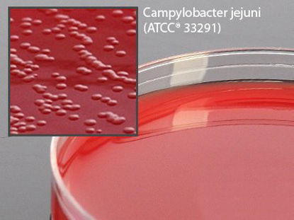 Picture of Prepared Media Cefoperazone, Vancomycin, Amphotericin B (Campy CVA) Agar with 5% Sheep Blood Petri Plate FormatA40