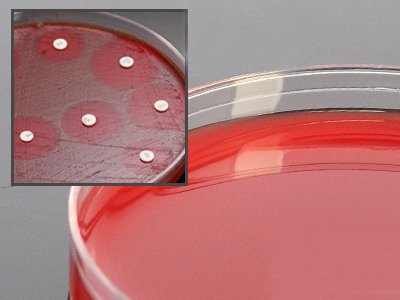 Picture of Prepared Media Mueller Hinton Agar with 5% Sheep Blood Plate FormatA59