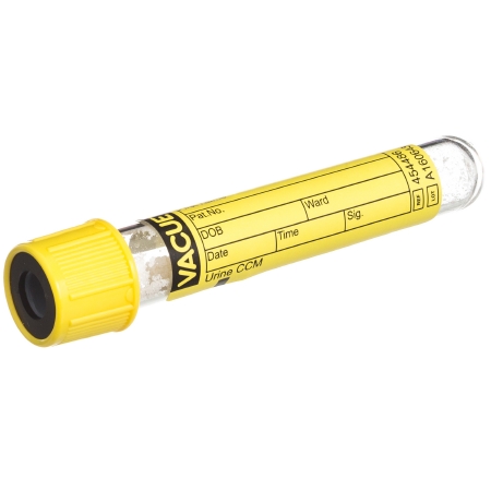 Picture of VACUETTE® Urinalysis Tube Round Bottom CCM (Count and Culture Mannitol) Additive 13 X 75 mm 4 mL Yellow / Black Ring Pull Cap Polyethylene Terephthalate (PET) Tube454486