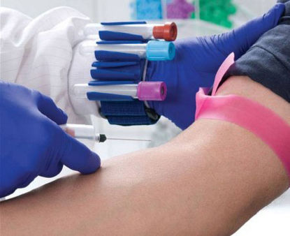 Picture of Tube Jockey Wristband / Holder Set For Holding 13 - 16 mm Tubes5000