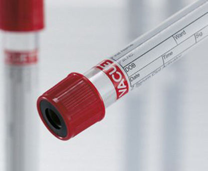 Picture of VACUETTE® Z Serum Clot Activator Venous Blood Collection Tube Serum Tube Clot Activator Additive 13 X 100 mm 6 mL Red / Black Ring Pull Cap Polyethylene Terephthalate (PET) Tube456048