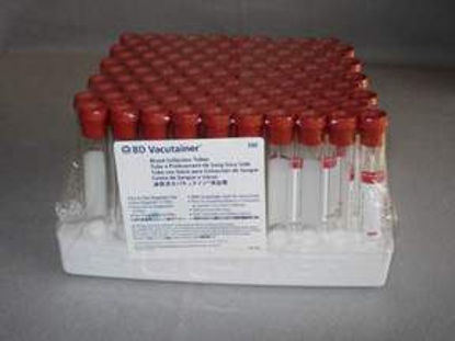 Picture of BD Vacutainer® Venous Blood Collection Tube Serum Tube Plain 16 X 100 mm 10 mL Red Conventional Closure Glass Tube02685A