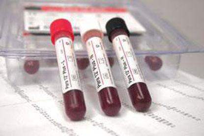 Picture of Hematology Control Para 12® Plus 12 X 3 mL218913