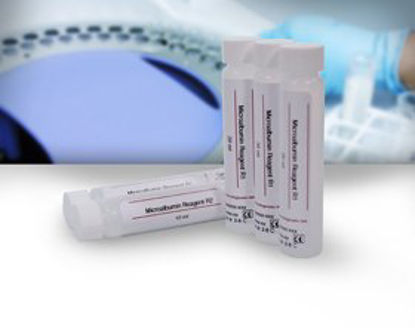 Picture of Reagent Renal / General Chemistry Microalbumin For Clinical Chemistry Analyzer 200 Tests R1: 4 X 20 mL, R2: 2 X 10 mLM7562100