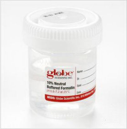 Picture of Prefilled Formalin Container Tite-Rite™ 48 X 60 mm Polypropylene 30 mL Fill in 60 mL Screw Cap Warning Label / Patient Information NonSterile6522FL