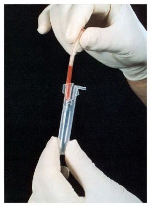 Picture of Segment Processor Alpha Scientific SEG·SAFE™ For Centrifuge15059350