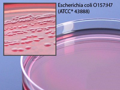 Picture of Prepared Media Cefixime Potassium Tellurite Sorbitol-MacConkey Agar (CT-SMAC) Mono-Plate FormatG129
