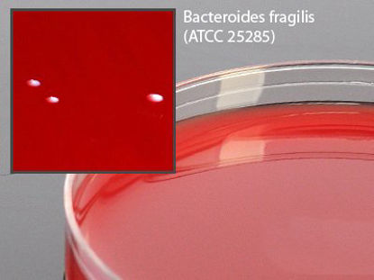 Picture of Prepared Media Anaerobic Phenylethyl Alcohol Agar (CDC formula) Mono-Plate FormatA90