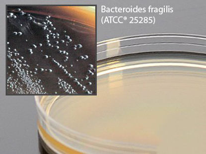 Picture of Prepared Media Bacteroides Bile Esculin Agar Mono-Plate FormatG05