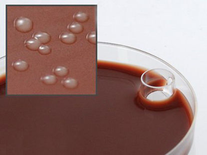 Picture of Prepared Media Martin Lewis with Lincomycin Mono-Plate FormatE31