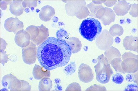 Picture of Modified Wright Stain Accustain® 1 LiterWS32-1L