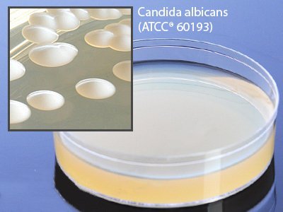 Picture of Prepared Media Sabdex (Sabouraud Dextrose) Agar Deep Fill Plate FormatW250