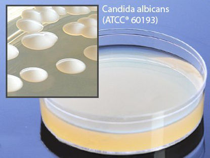 Picture of Prepared Media Sabdex (Sabouraud Dextrose) Agar Deep Fill Plate FormatW250